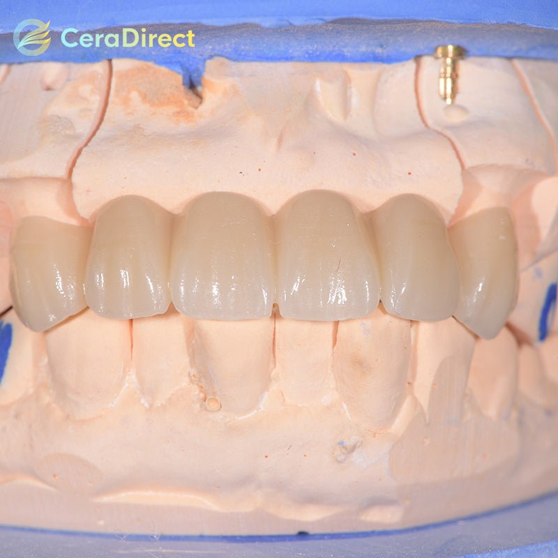 3D Pro—Multilayer Zirconia Disc Open System (98mm)C1-D4 - CeraDirect